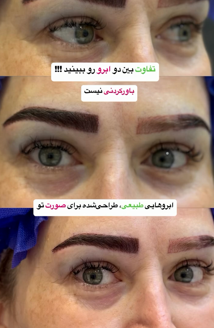 قبل و بعد کاشت ابرو روی تاتو 3 قبل و بعد کاشت ابرو روی تاتو 3